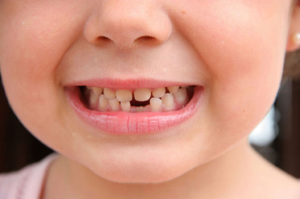 Asnjëherë mos i hidhni dhëmbët e bebeve: Mund t’iu shpëtojnë jetën!