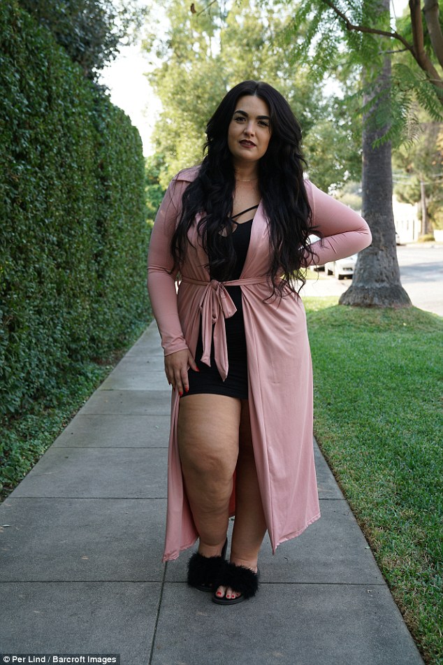 30-vjeçarja me këmbët e fryra që po “çmend” Instagramin (Foto) 30-vjeçarja me këmbët e fryra që po “çmend” Instagramin (Foto)