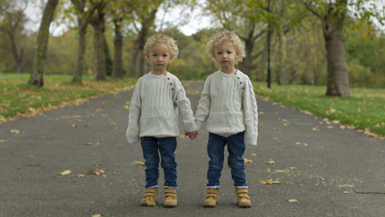 Imazhe mbresëlënëse të binjakëve identikë (Foto) Imazhe mbresëlënëse të binjakëve identikë (Foto)