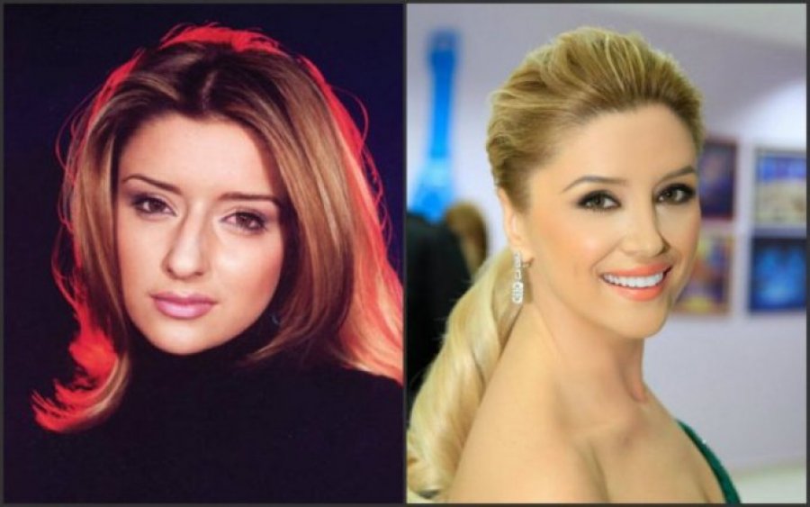 Nëse nuk do të i’a shkruanim emrin askush nuk do ta njihte! Kjo është Alketa Vejsiu para operacioneve! Nëse nuk do të i’a shkruanim emrin askush nuk do ta njihte! Kjo është Alketa Vejsiu para operacioneve!