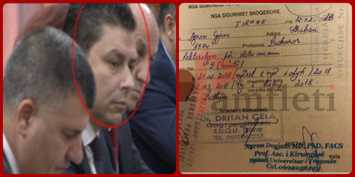 “Jam me hemorroide”: Justifikimi i Prokurorit me “stop” nga SHBA-ja, për të mos shkuar në Pukë dhe si erdheinë Tiranë?! “Jam me hemorroide”: Justifikimi i Prokurorit me “stop” nga SHBA-ja, për të mos shkuar në Pukë dhe si erdheinë Tiranë?!