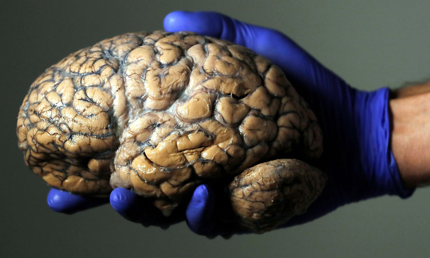 Një hap drejt pavdekshmërisë? Mbahet 36 orë në “jetë” truri pa trup Një hap drejt pavdekshmërisë? Mbahet 36 orë në “jetë” truri pa trup