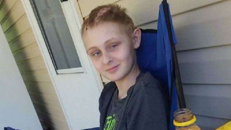 Ndodh mrekullia, 13 vjeçari zgjohet nga koma, 1 ditë para se ti fiknin aparaturat Ndodh mrekullia, 13 vjeçari zgjohet nga koma, 1 ditë para se ti fiknin aparaturat