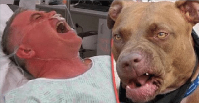 Vdes qytetari që u kafshua nga pitbulli në Elbasan, një tjetër kafshohet në Tiranë Vdes qytetari që u kafshua nga pitbulli në Elbasan, një tjetër kafshohet në Tiranë