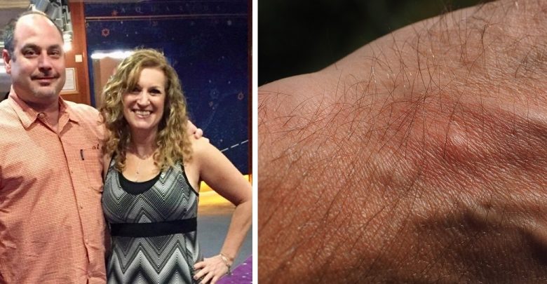 Vuri re diçka që burrit i ndodhte në shtrat, pas 23 vitesh bashkë gruaja merr lajmin e hidhur por se kthen dot kohen pas Vuri re diçka që burrit i ndodhte në shtrat, pas 23 vitesh bashkë gruaja merr lajmin e hidhur por se kthen dot kohen pas