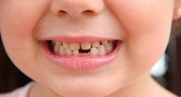 Asnjëherë mos i hidhni dhëmbët e bebeve: Mund t’iu shpëtojnë jetën!
