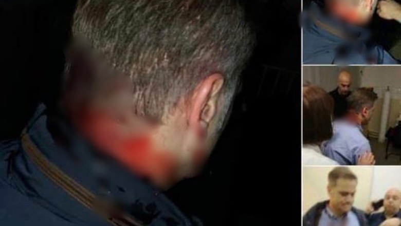 Me plagë në kokë, për.gjaket ish-negociatori serb në bisedimet me Kosovën Me plagë në kokë, për.gjaket ish-negociatori serb në bisedimet me Kosovën