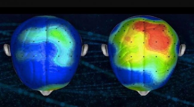 VIDEO/ Zbulohet një këngë që redukton ankthin në 65% VIDEO/ Zbulohet një këngë që redukton ankthin në 65%