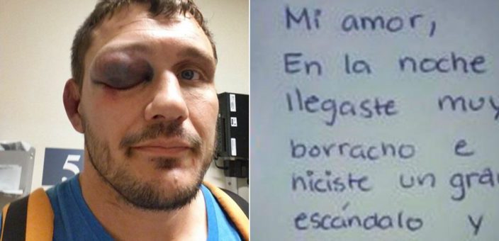 Zgjohet me sy të nxirë, burri shpërthen në lot kur sheh shënimin që i ka lënë gruaja e tij Zgjohet me sy të nxirë, burri shpërthen në lot kur sheh shënimin që i ka lënë gruaja e tij