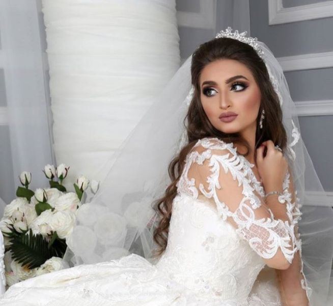 Iluzioni: I ikën mendja nuses, “ngre fustanin” dhe i tregon të gjitha! Foto bëhet virale në internet Iluzioni: I ikën mendja nuses, “ngre fustanin” dhe i tregon të gjitha! Foto bëhet virale në internet