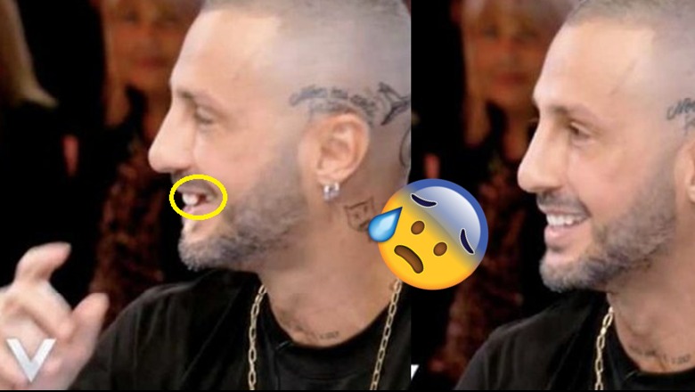 I bie dhëmbi gjatë intervistës, paparazzi i VIP-ave vrapon në studio për ta gjetur (Video) I bie dhëmbi gjatë intervistës, paparazzi i VIP-ave vrapon në studio për ta gjetur (Video)