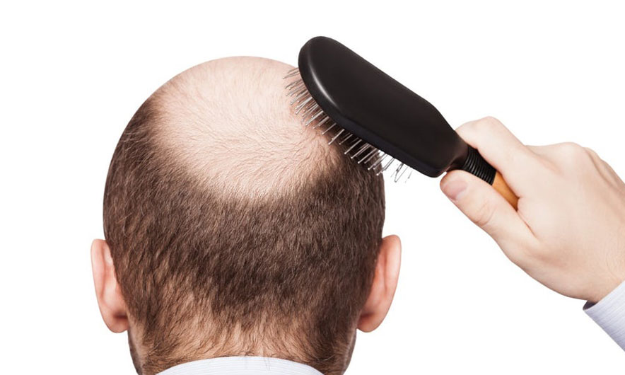 Zbulohet aksidentalisht kura kundër “qerosllëkut” Zbulohet aksidentalisht kura kundër “qerosllëkut”