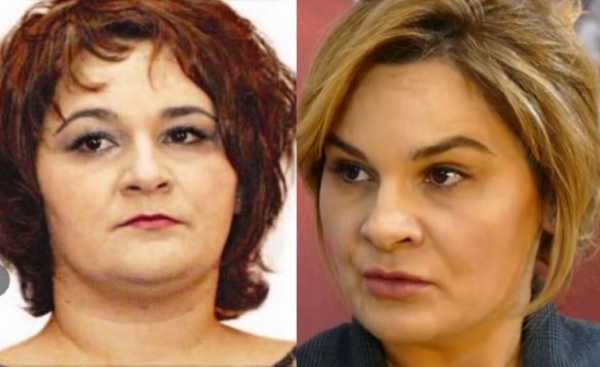 Varfëria intelektuale e Kryemadhit është e frikshme! Gratë e Ramës janë “eskortë” kurse unë jam fisnike dhe… pasanike! Varfëria intelektuale e Kryemadhit është e frikshme! Gratë e Ramës janë “eskortë” kurse unë jam fisnike dhe… pasanike!