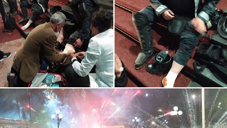 “K.riminel, 30 vite v.rasje”, shpërthen Erion Braçe pas protestës dhe i nxjerr prapaskenat tronditëse Berishës! (Foto) “K.riminel, 30 vite v.rasje”, shpërthen Erion Braçe pas protestës dhe i nxjerr prapaskenat tronditëse Berishës! (Foto)