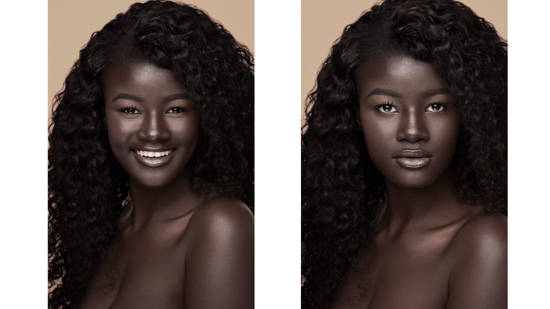 Ngjyra e lëkurës e shndërroi në yllin e mediave sociale! (Foto)