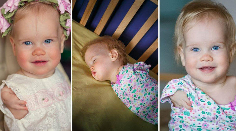 Lindi pa krahë dhe prindërit e lanë në mëshirë të fatit, ndodh mrekullia me vogëlushen 2-vjeçare Lindi pa krahë dhe prindërit e lanë në mëshirë të fatit, ndodh mrekullia me vogëlushen 2-vjeçare