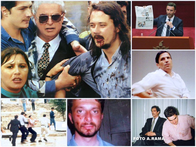 Braçe, Dokle e Servet Pëllumbi me fytyrë të gjakosur, Rama publikon fotot: “Kjo kohë ishte fashizëm!”