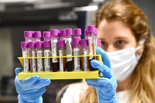 Studimi i rëndësishëm: Ata që kalojnë Covid, fitojnë imunitet të përhershëm Studimi i rëndësishëm: Ata që kalojnë Covid, fitojnë imunitet të përhershëm