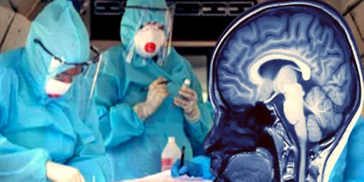 Covid-19 mund të shkaktojë dëmtime të rënda në tru edhe për ata që e kalojnë me simptoma më të lehta Covid-19 mund të shkaktojë dëmtime të rënda në tru edhe për ata që e kalojnë me simptoma më të lehta