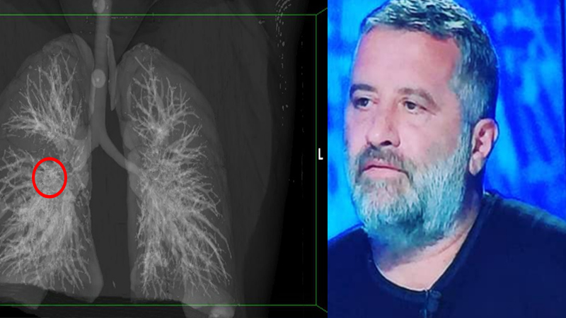 Mjeku i QSUT publikon foton dhe ‘thumbon’ Ministrinë e Shëndetësisë për masat e marra ndaj koronavirusit: Siguruam sot pampersa për të sëmurët! Mjeku i QSUT publikon foton dhe ‘thumbon’ Ministrinë e Shëndetësisë për masat e marra ndaj koronavirusit: Siguruam sot pampersa për të sëmurët!