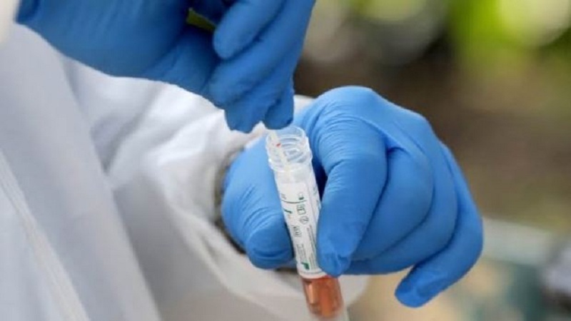 2 viktima dhe 108 raste të reja me COVID-19 në Maqedoninë Veriore