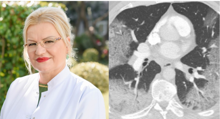 Mjekja shpërthen kundër teoricienëve konspirativë: Palaço që helmojnë miletin, lutuni për frymë kur të vini në spital në dorë të mjekëve Mjekja shpërthen kundër teoricienëve konspirativë: Palaço që helmojnë miletin, lutuni për frymë kur të vini në spital në dorë të mjekëve