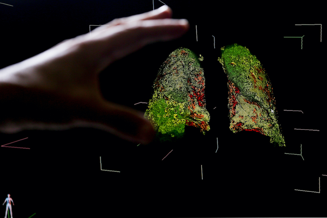 Publikohet studimi më i fundit i koronavirusit: A mund të infektohemi pasi e kemi kaluar Covid-19 Publikohet studimi më i fundit i koronavirusit: A mund të infektohemi pasi e kemi kaluar Covid-19