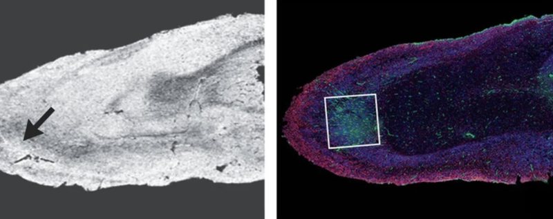 Shkencëtarët zbulojnë dëmin që mund të shkaktojë Covid-19 në trurin e njeriut Shkencëtarët zbulojnë dëmin që mund të shkaktojë Covid-19 në trurin e njeriut