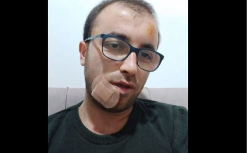 Rrëfehet gazetari i cili u dhunua për shkak të detyrës: Njërin prej agresorëve e godita me thikë Rrëfehet gazetari i cili u dhunua për shkak të detyrës: Njërin prej agresorëve e godita me thikë