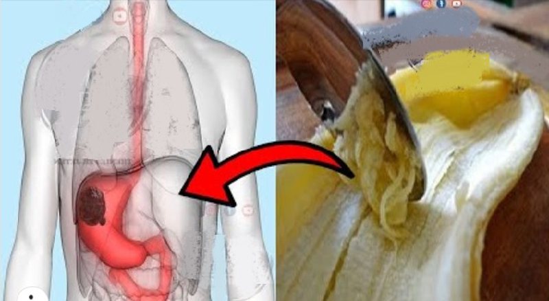 Si nuk e paskemi ditur më parë?! Bananet kanë aftësinë të kurojnë këto probleme shëndetësore mjaft të përhapura Si nuk e paskemi ditur më parë?! Bananet kanë aftësinë të kurojnë këto probleme shëndetësore mjaft të përhapura