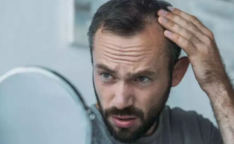 Kushtet mjekësore që mund të shkaktojnë rënie të flokëve Kushtet mjekësore që mund të shkaktojnë rënie të flokëve