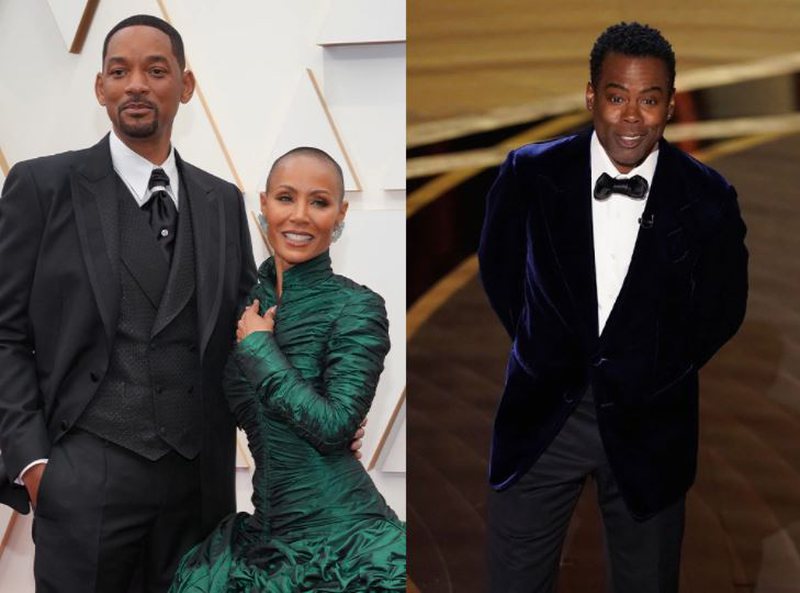 Nga se vuan gruaja e Will Smith? Çfarë është alopecia dhe çfarë fshihet pas debatit në ceremoninë e ndarjes së çmimeve ‘Oscar’ Nga se vuan gruaja e Will Smith? Çfarë është alopecia dhe çfarë fshihet pas debatit në ceremoninë e ndarjes së çmimeve ‘Oscar’