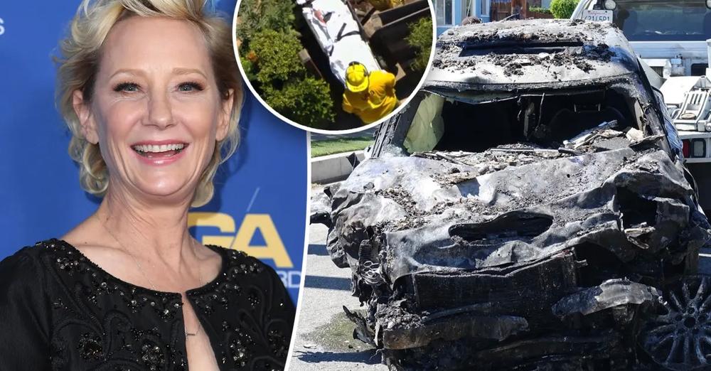 U përplas me makinë, nuk mbijetoi dot, vdes tragjikisht aktorja e njohur Anne Heche U përplas me makinë, nuk mbijetoi dot, vdes tragjikisht aktorja e njohur Anne Heche