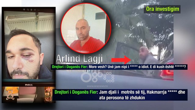 “Të q*** rracën, do të të bëj thela –thela” ! Drejtori i Doganës Fier kërcënon me jetë qytetarin që  i “pallonte” gruan