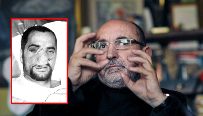 Fatos Lubonja: E rrahën barbarisht Edi Ramën, horrat e Sali Berishës Fatos Lubonja: E rrahën barbarisht Edi Ramën, horrat e Sali Berishës