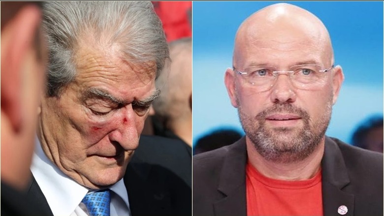 Basha, mashtruesi flokë llakosur! Del nga “kolibja” Ylli Manjani: SHBA vendi i propagandës dhe Berisha heroi që duron grushta! Basha, mashtruesi flokë llakosur! Del nga “kolibja” Ylli Manjani: SHBA vendi i propagandës dhe Berisha heroi që duron grushta!