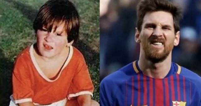 Historia e Lionel Messit, si mundi një sëmundje të rrallë dhe u bë një nga futbollistët më të mëdhenj në botë Historia e Lionel Messit, si mundi një sëmundje të rrallë dhe u bë një nga futbollistët më të mëdhenj në botë