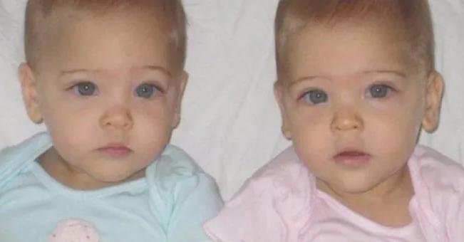 Dy binjaket identike, të lindura në vitin 2007, tani janë rritur: Flitet se janë ndër më të bukurat në të gjithë botën Dy binjaket identike, të lindura në vitin 2007, tani janë rritur: Flitet se janë ndër më të bukurat në të gjithë botën