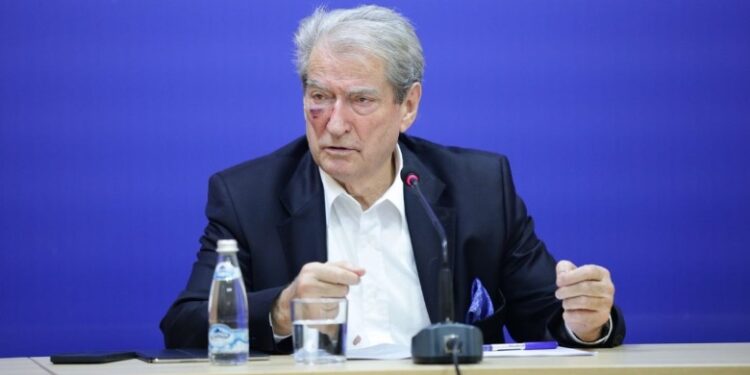 Strategjia e Berishës që tregon se “atentatin” me grusht ndaj tij e organizoi vetë Strategjia e Berishës që tregon se “atentatin” me grusht ndaj tij e organizoi vetë