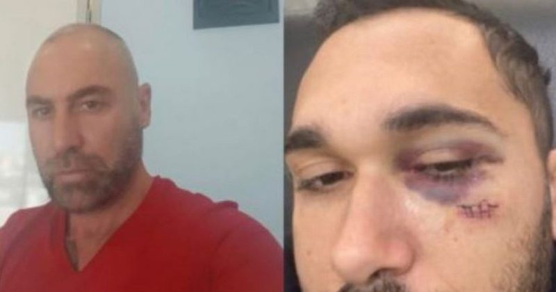 Ish drejtori i doganës Fierit i kallzuar për kanosje të burrit të dashnores, 2 aksidente në tentativë për tu fshehur Ish drejtori i doganës Fierit i kallzuar për kanosje të burrit të dashnores, 2 aksidente në tentativë për tu fshehur