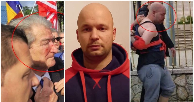 Sulmi me grusht ndaj Sali Berishës, mjekësia ligjore del me deklaratën e fundit për Gert Shehun Sulmi me grusht ndaj Sali Berishës, mjekësia ligjore del me deklaratën e fundit për Gert Shehun