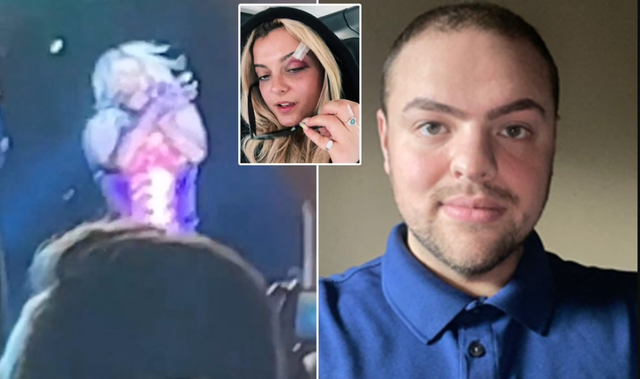 Ky është agresori që i shkaktoi tre të qepura Bebe Rexhës Ky është agresori që i shkaktoi tre të qepura Bebe Rexhës