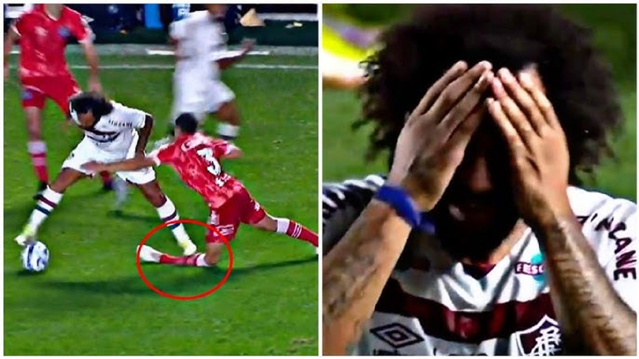Marcelo i thyen këmbën e kundërshtarit dhe shpërthen në lot në fushë. Pamjet janë të frikshme… (Video) Marcelo i thyen këmbën e kundërshtarit dhe shpërthen në lot në fushë. Pamjet janë të frikshme… (Video)