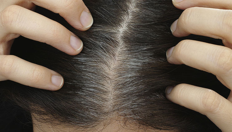 Shkencëtarët zbulojnë arsyen e thinjave në flokë! Ju mund të mësoni se si mund ta evitoni