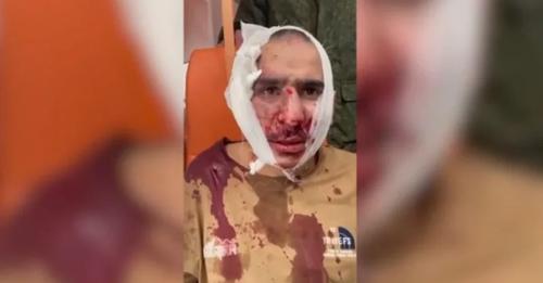 Momenti i arrestimit të terroristit të sulmit në Moskë: I mbuluar me gjak…e ka pak! Momenti i arrestimit të terroristit të sulmit në Moskë: I mbuluar me gjak…e ka pak!