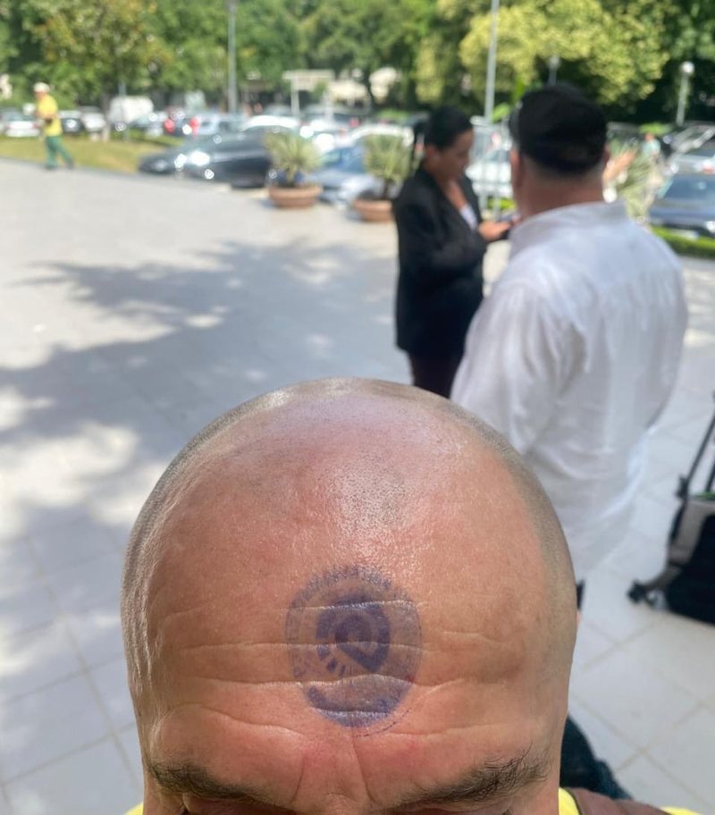 FOTOLAJM/ Ta gëzoni vulën…në ballë! FOTOLAJM/ Ta gëzoni vulën…në ballë!