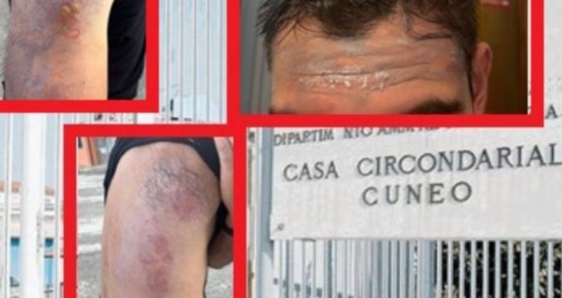 Trazira në burgun italian, të dënuarit hedhin vaj të nxehtë ndaj gardianëve: Situata është ende jashtë kontrollit Trazira në burgun italian, të dënuarit hedhin vaj të nxehtë ndaj gardianëve: Situata është ende jashtë kontrollit