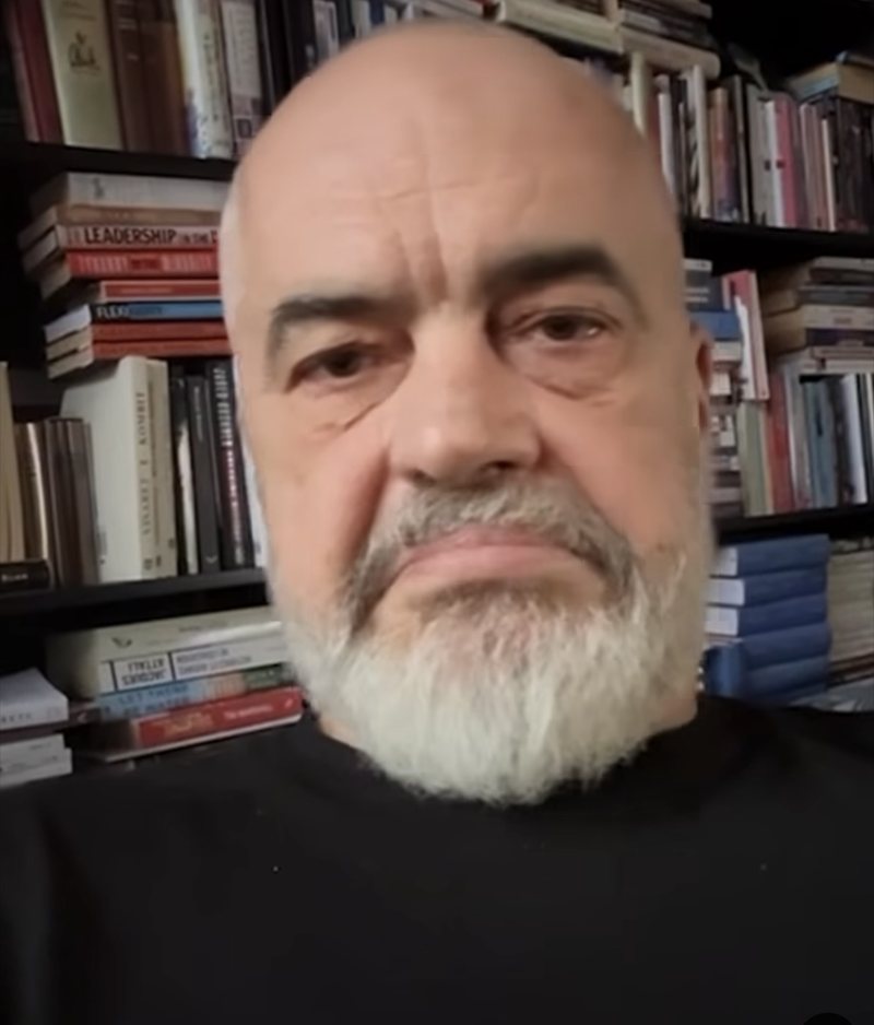 Rama-komentuesit: Partia që të ka mbushur mendjen se jam drogaxhi më ka thyer hundën dhe kafkën me leva! Shqipëria ka nevojë për një opozitë dinjitoze Rama-komentuesit: Partia që të ka mbushur mendjen se jam drogaxhi më ka thyer hundën dhe kafkën me leva! Shqipëria ka nevojë për një opozitë dinjitoze