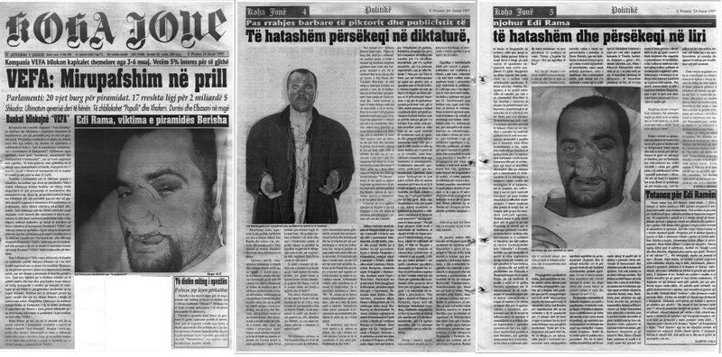 “Mos i jepni ilaç, le të vdesë” – Nikoll Lesi: Çfarë i thoshin agjentët e SHIK-ut mjekëve, pasi u rrah Edi Rama në ‘97 “Mos i jepni ilaç, le të vdesë” – Nikoll Lesi: Çfarë i thoshin agjentët e SHIK-ut mjekëve, pasi u rrah Edi Rama në ‘97