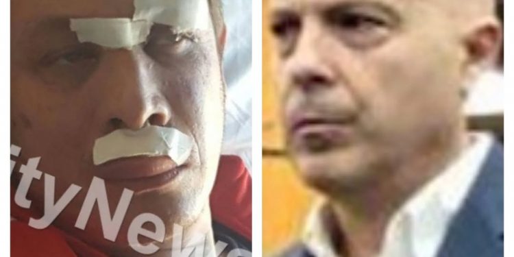 Përgjimet e Veliajt / Mero Baze: Dumani të hetojë spiunin ordiner Elvi Fundo dhe Ols Dadon për nxjerrjen e sekreteve hetimore